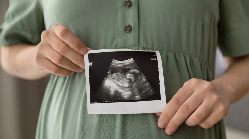  El estado de Georgia calificará a los fetos como dependientes en relación a la exención de impuestos 