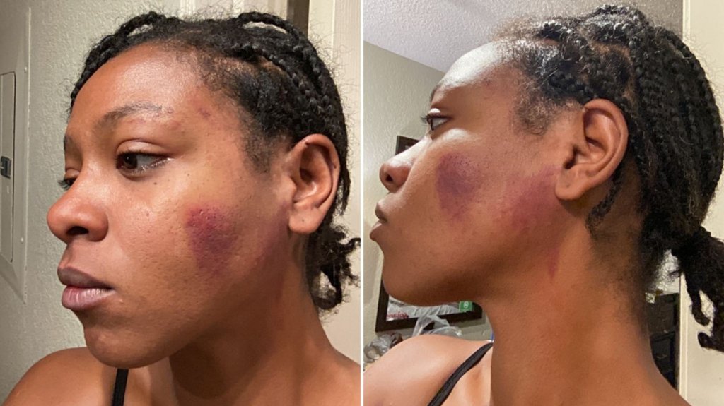  Video:Policía de EE. UU. suspendido 40 horas por golpear a mujer afroamericana durante arresto 